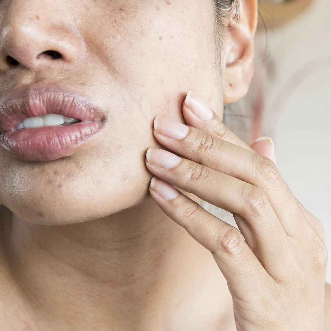 Tips for Dry Skin